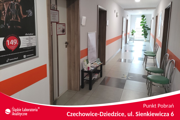 Punkt Pobrań krwi ŚLA Czechowice-Dziedzice Sienkiewicza 6